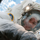 Illustration for article titled Laser Analysis Reveals That Astronauts Skin Gets Thinner in Space